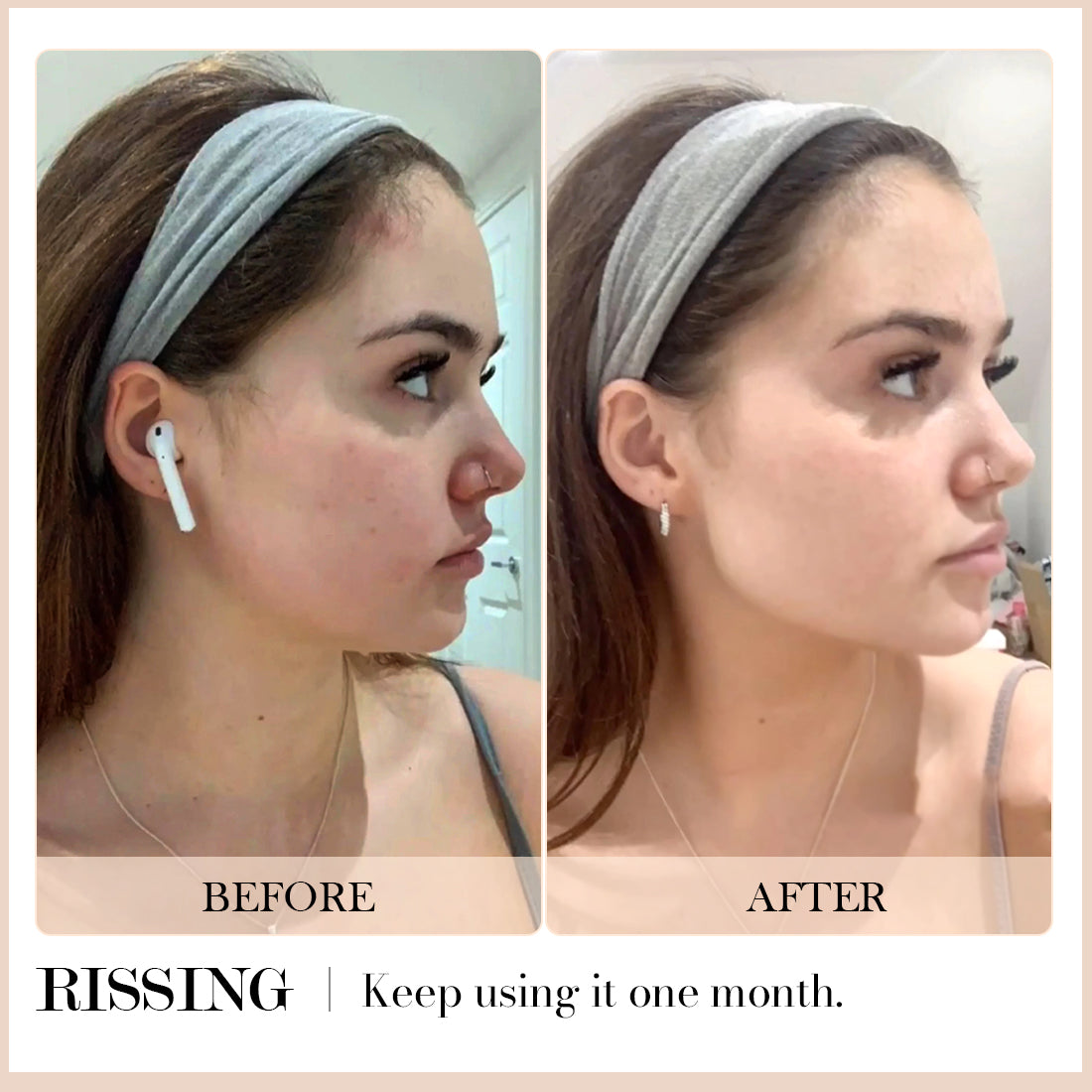 RISSING 4-in-1 Face Massager Set - Face Roller & Neck Massager, Stainless Steel Gua Sha Facial Tools - For Lymphatic Drainage, Cellulite Reduction, and Skin Tightening RI-AZ003